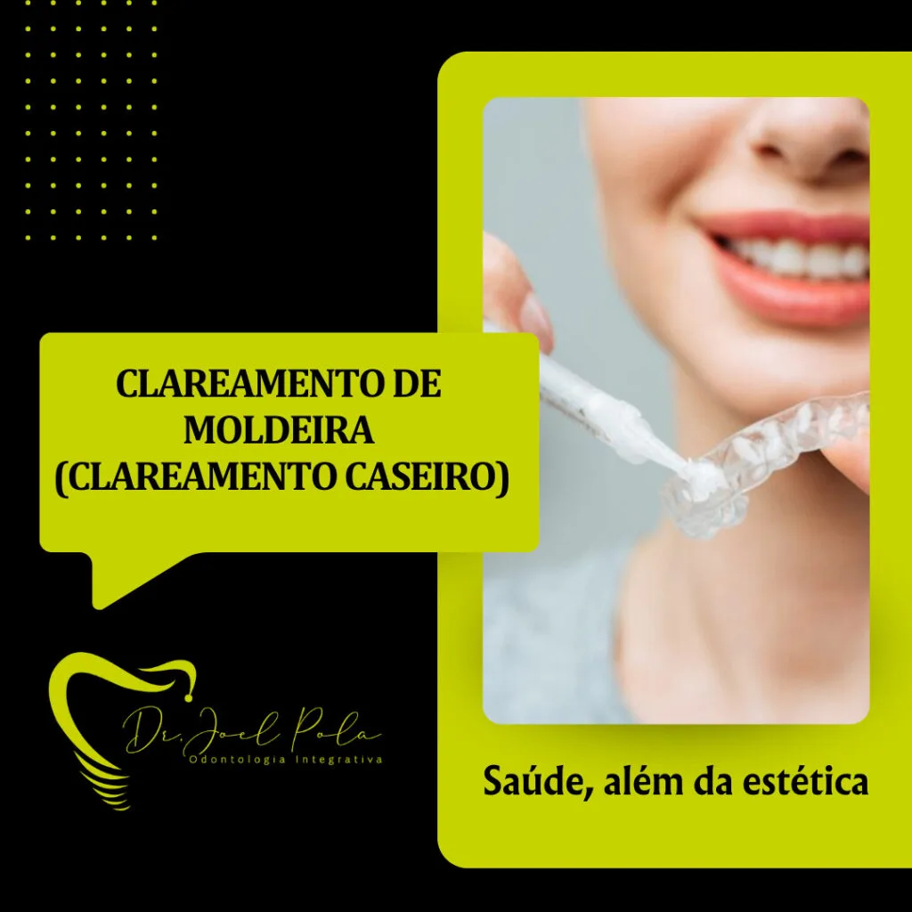 Moldeira