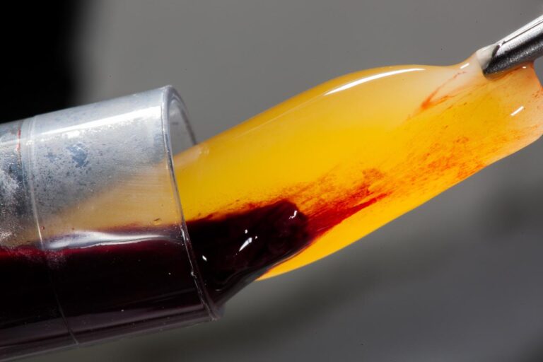 Plasma rico em fibrina